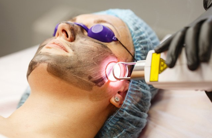 Laser Treatment For Skin in Lokhandwala-Andheri