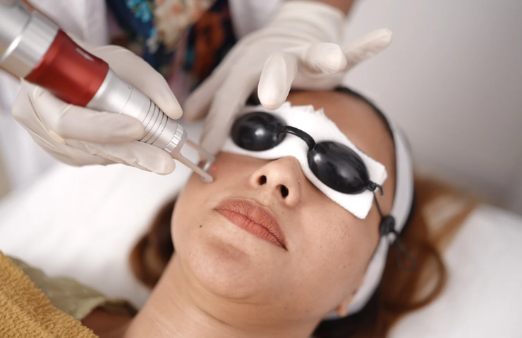 Fractional Co2 Laser Treatment Cost in Andheri