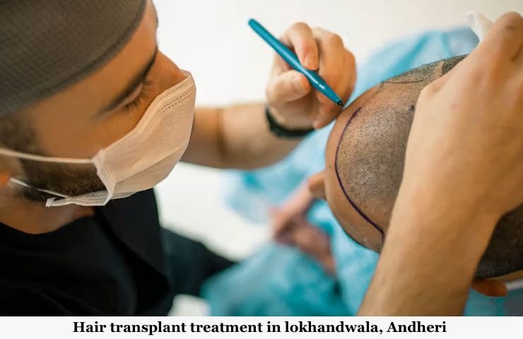 Hair transplant treatment in lokhandwala, Andheri