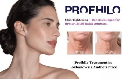 Profhilo Treatment in Lokhandwala Andheri Price (2)