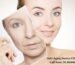 Anti-Aging Doctor Clinic Botox for Elite Business Owners in Mumbai