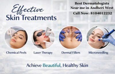 Best Dermatologists Near me in Andheri West