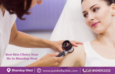 Best Skin Clinics Near Me in Bhandup West