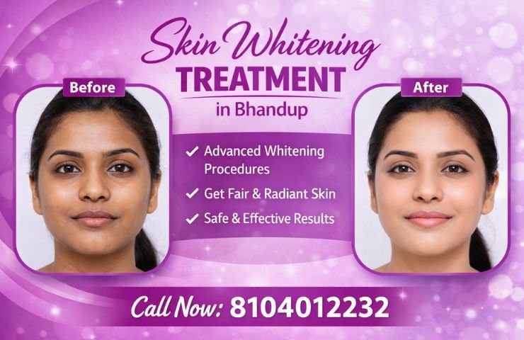 Skin Whitening Treatment in Bhandup