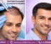 Best Hair Transplant Treatment in Mumbai