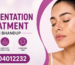 Top Pigmentation Treatment Clinic in Bhandup