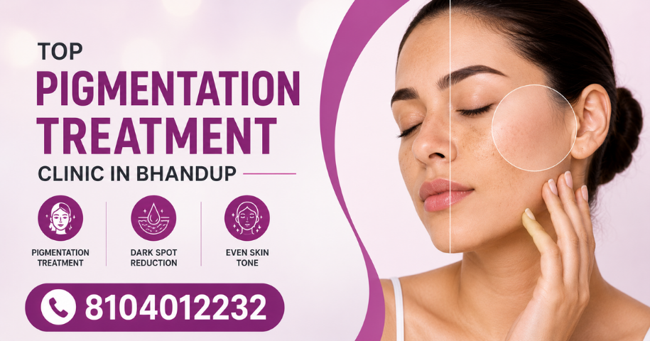 Top Pigmentation Treatment Clinic in Bhandup