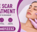 Acne Scar Treatment Specialist in Bhandup