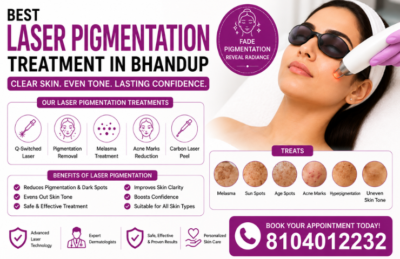 Best Laser Pigmentation Treatment In Bhandup
