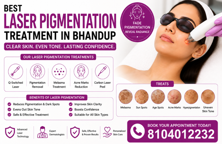 Best Laser Pigmentation Treatment In Bhandup