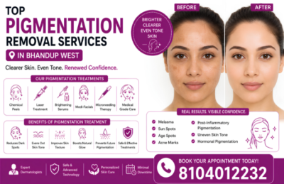 Top Pigmentation Removal Services in Bhandup West