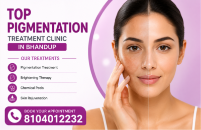 Top Pigmentation Treatment Clinic in Bhandup