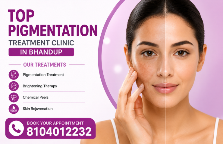 Top Pigmentation Treatment Clinic in Bhandup