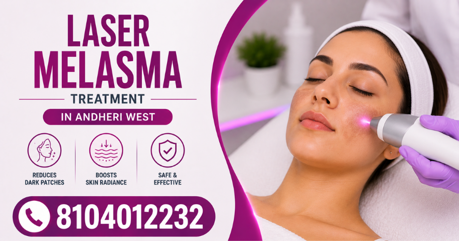 Laser Melasma Treatment in Andheri West