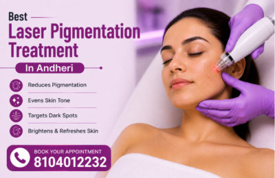 Best Laser Pigmentation Treatment In Andheri
