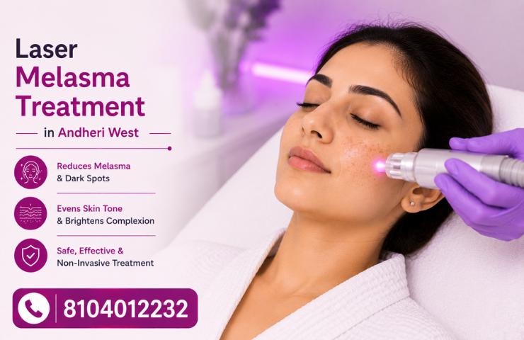 Laser Melasma Treatment in Andheri West