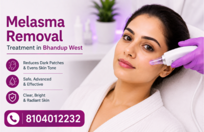 Melasma Removal Treatment in Bhandup West