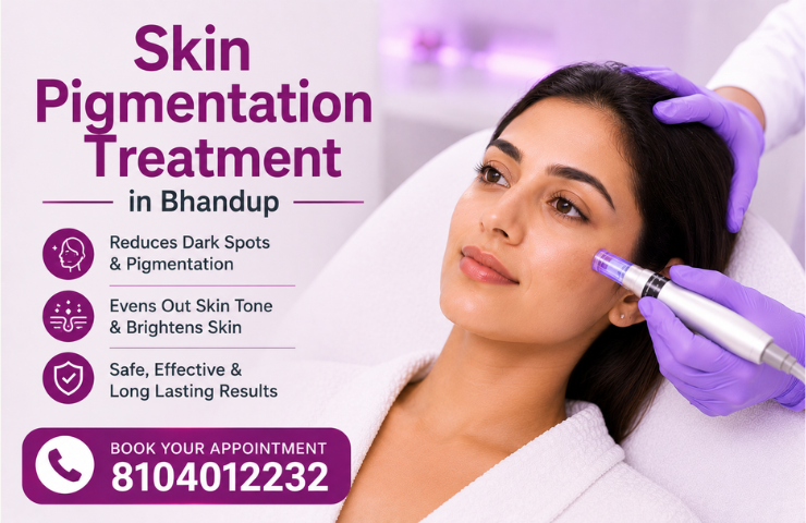 Skin Pigmentation Treatment in Bhandup