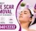 Best Acne Scar Removal Specialist in Bhandup