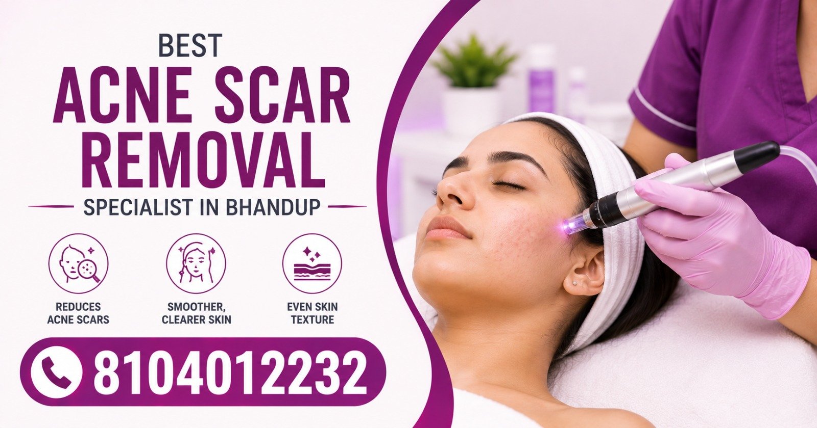 Best Acne Scar Removal Specialist in Bhandup