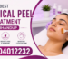 Best Chemical Peel Treatment in Bhandup