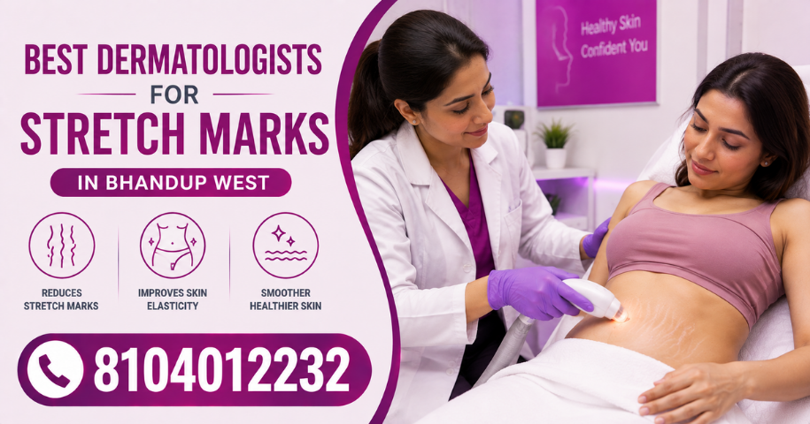 Best Dermatologists For Stretch Marks in Bhandup West