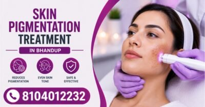 Skin Pigmentation Treatment in Bhandup