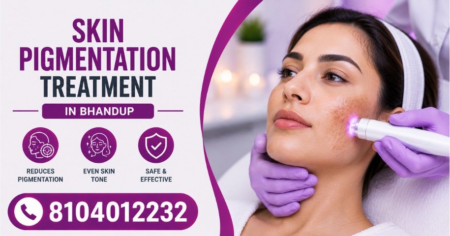 Skin Pigmentation Treatment in Bhandup